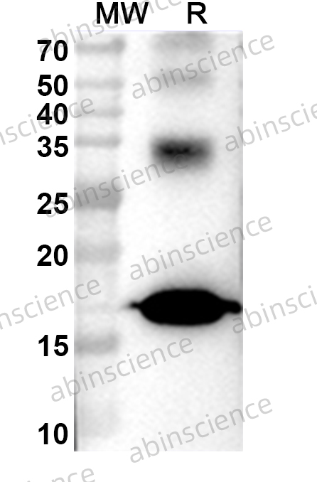 Anti-Human PIP Monoclonal Antibody (1A570)