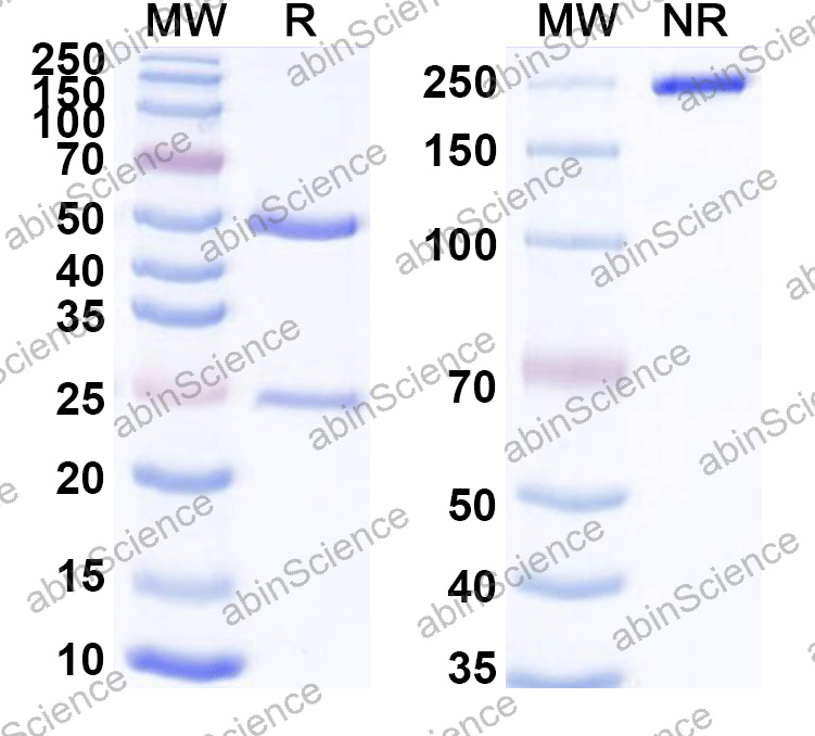 Anti-Human CTSB Monoclonal Antibody (1A489)
