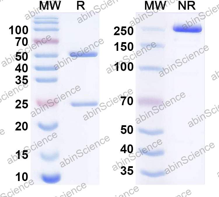 Anti-Human CTSB Monoclonal Antibody (1A491)