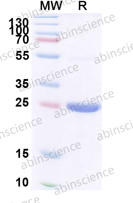 Human ADRB1 Recombinant Protein (N-His-KSI)