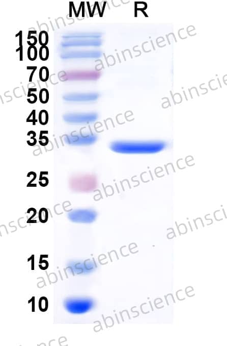 Human CFH Recombinant Protein (C-His)