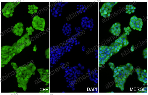 Anti-Human CFH Recombinant Nanobody (SAA2038)