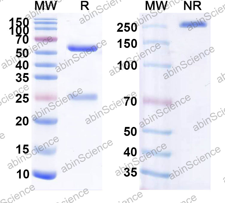 Anti-Human CALB1 Monoclonal Antibody (1A643)