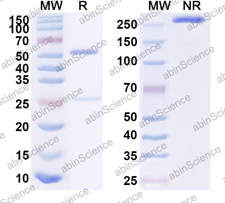 Anti-Human CALB1 Monoclonal Antibody (1A644)