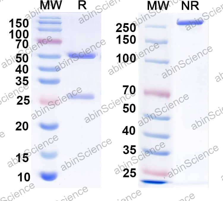 Anti-Calbindin Antibody (L109/87)