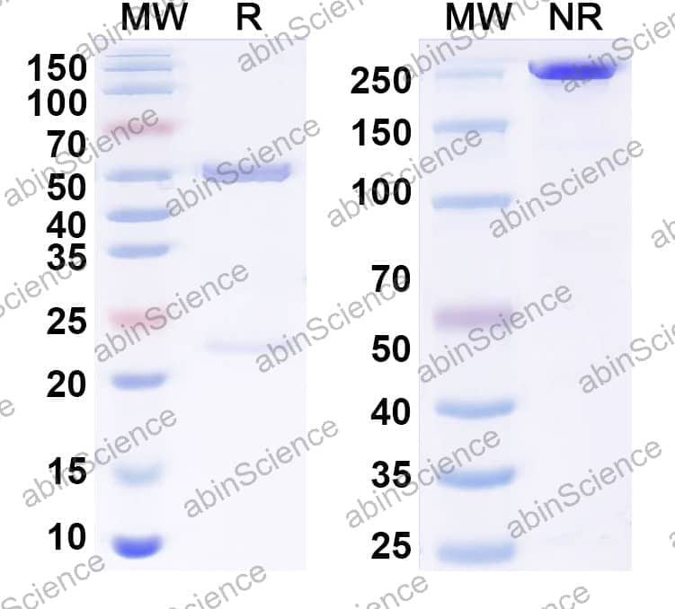 Anti-Human RBP4 Monoclonal Antibody (1A395)