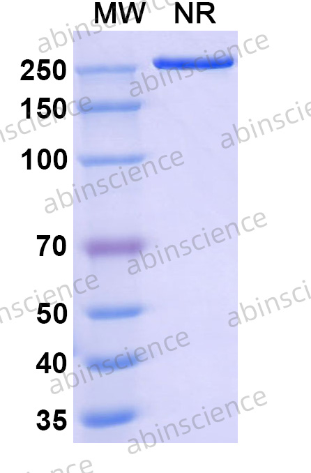 Anti-Human CD90/THY1 Recombinant Antibody (H5)