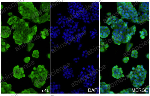 Anti-Human Complement C4b Recombinant Nanobody (SAA3062)