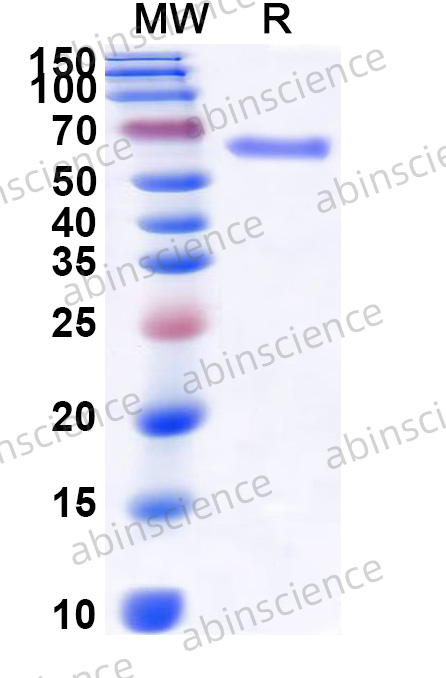 Human DLAT/PDC-E2 Recombinant Protein (C-Strep)