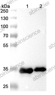 Anti-Der f 1 Recombinant Antibody (SAA0174)