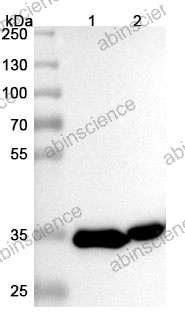 Anti-Der f 1 Recombinant Antibody (SAA0187)