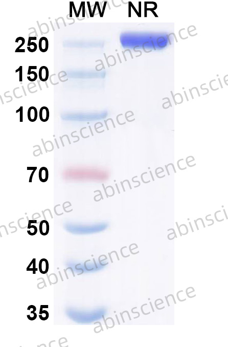 Anti-Der p 2 Human IgE Recombinant Antibody (2F10)