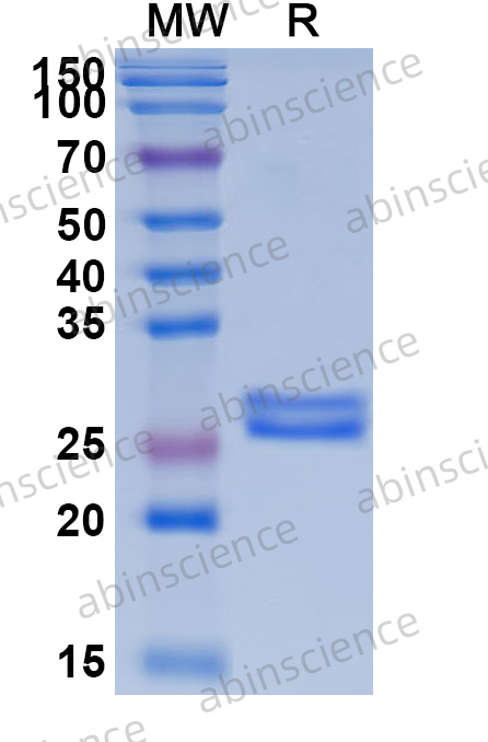 Anti-Pseudomonas aeruginosa PcrV Reference Antibody (Rivabazumab, RUO)