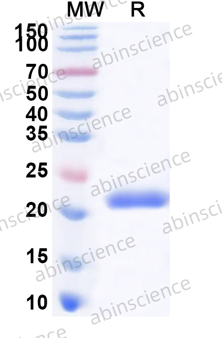 Salmonella typhi murA Recombinant Protein (N-His)