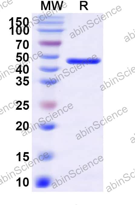 Helicobacter pylori babA Recombinant Protein (N-His)