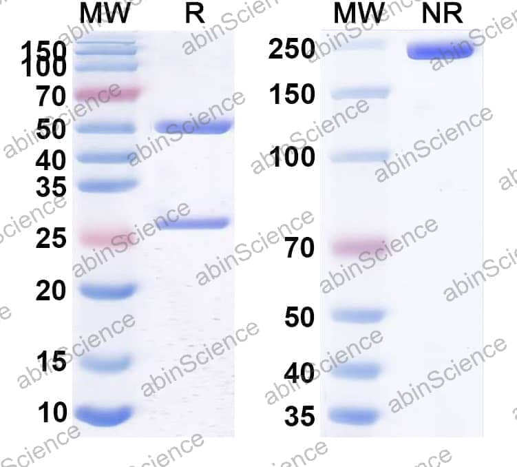 Anti-Helicobacter pylori babA Recombinant Antibody (SAA2271)