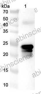 Anti-Klebsiella pneumoniae RamR Polyclonal Antibody