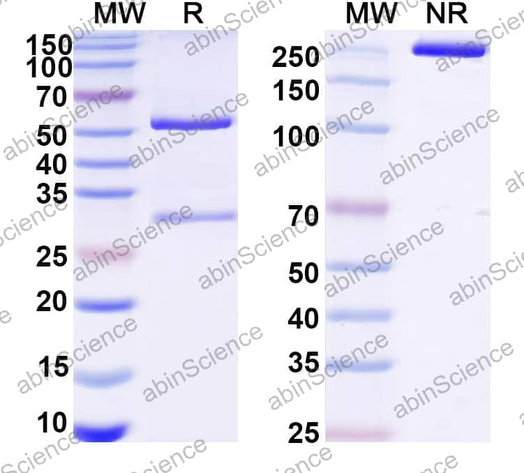 Anti-Mycolicibacterium chubuense AftB Recombinant Antibody (SAA2299)