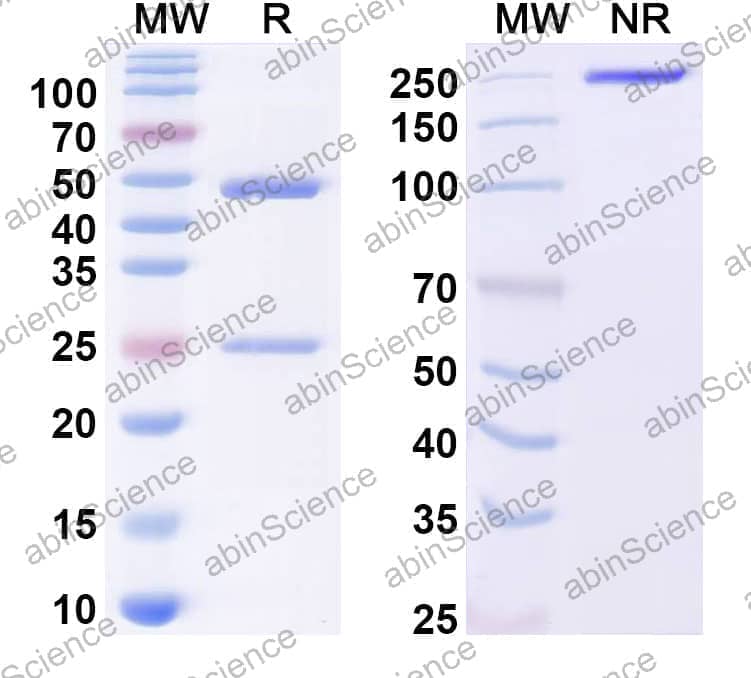 Anti-Plasmodium vivax PVDR Recombinant Antibody (SAA2302)