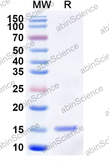 Profilin Recombinant Protein (N-His)