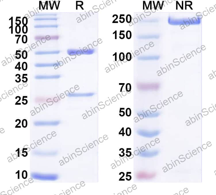 Anti-Profilin Recombinant Antibody (SAA2304)