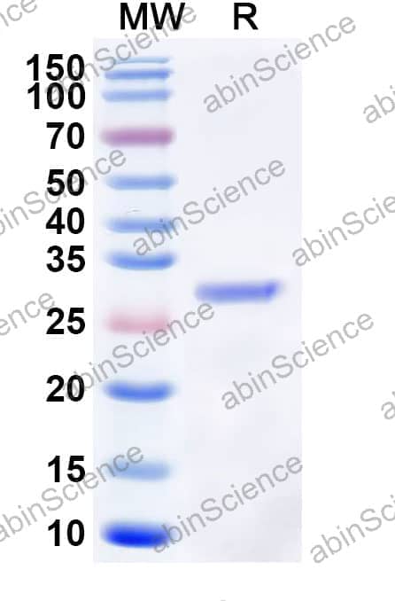 Beta-lactamase CTX-M-4 Recombinant Protein (N-His)