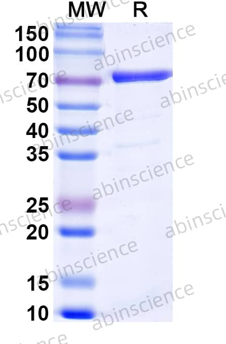 PBP2a Recombinant Protein (C-His)