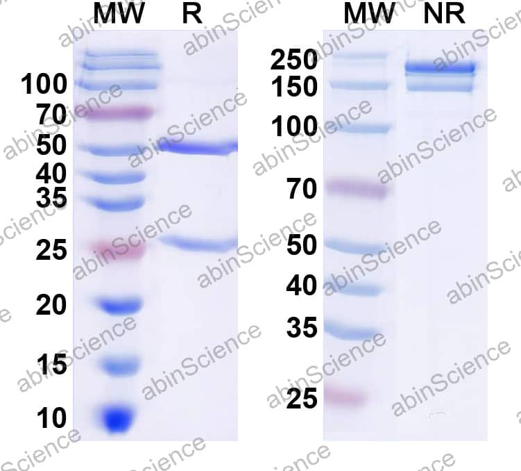 Anti-Cryptosporidium parvum CPS-500 antigen Recombinant Antibody (SAA2329)