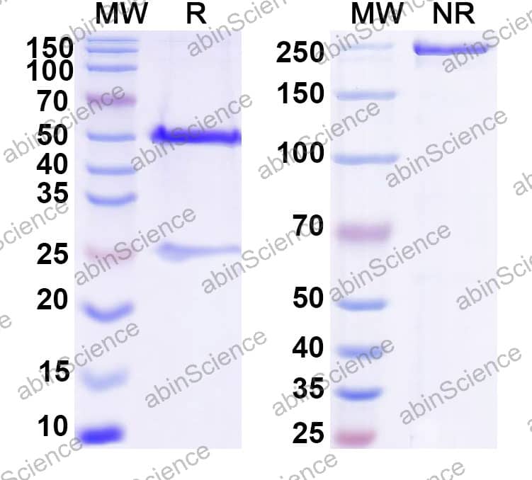 Anti-Cryptosporidium parvum GP25-200 antigen Recombinant Antibody (SAA2328)