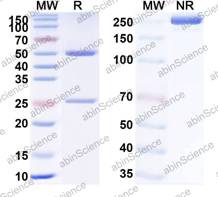 Anti-Cryptosporidium parvum Apical complex glycoprotein CSL Recombinant Antibody (SAA2327)