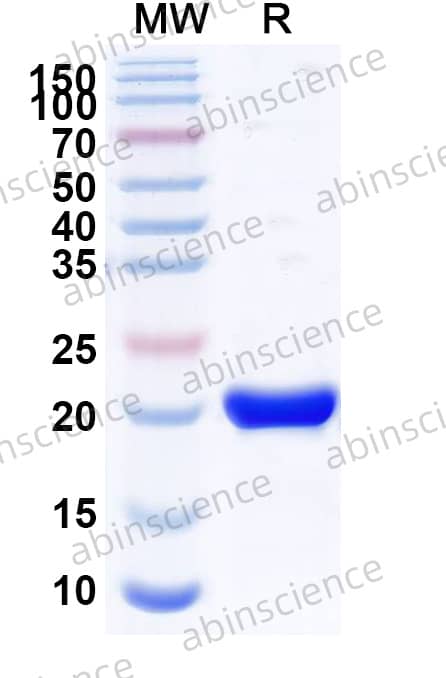 Borreliella burgdorferi DbpA Recombinant Protein (C-His)
