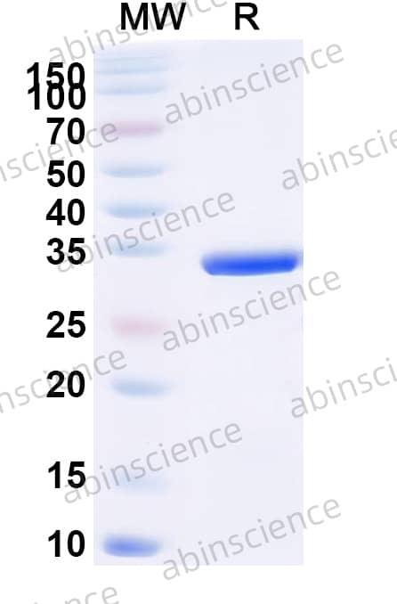 Borreliella burgdorferi ospA Recombinant Protein ()