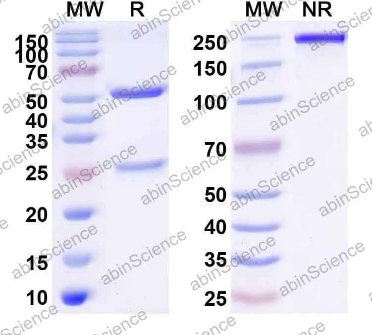 Anti-Borreliella burgdorferi ospA Recombinant Antibody (SAA2243)