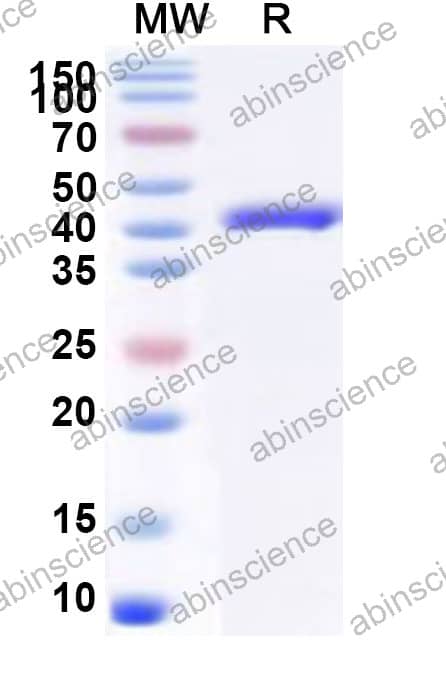 cellobiose 2-epimerase Recombinant Protein (N-His)