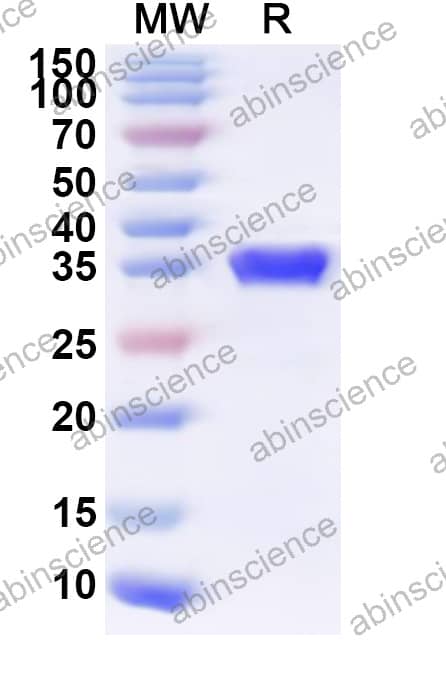 cas13a Recombinant Protein (N-His)