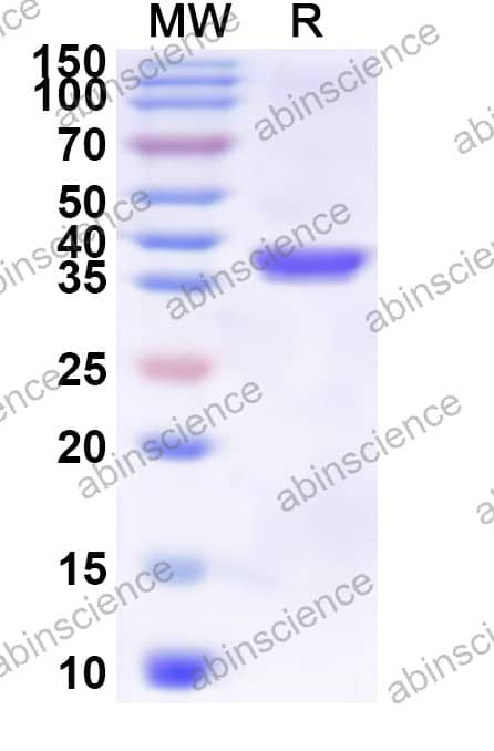 GrpE Recombinant Protein (N-His)