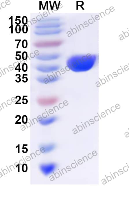 thermonuclease Recombinant Protein (N-His)