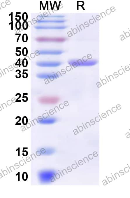 fliC Recombinant Protein (N-His)