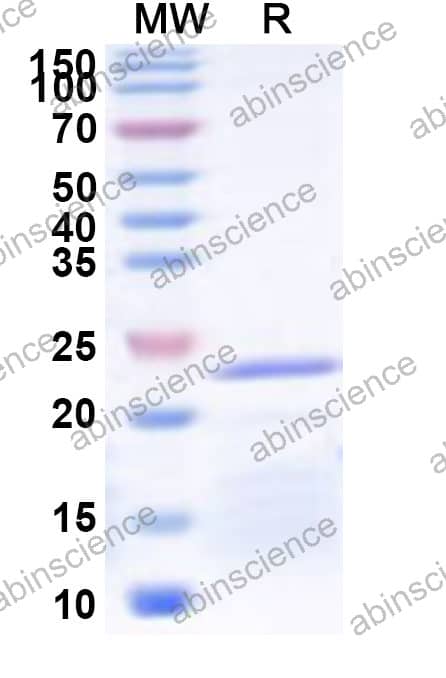 Adhesin Recombinant Protein (N-His)