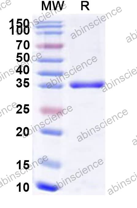 cas12f Recombinant Protein (N-His)