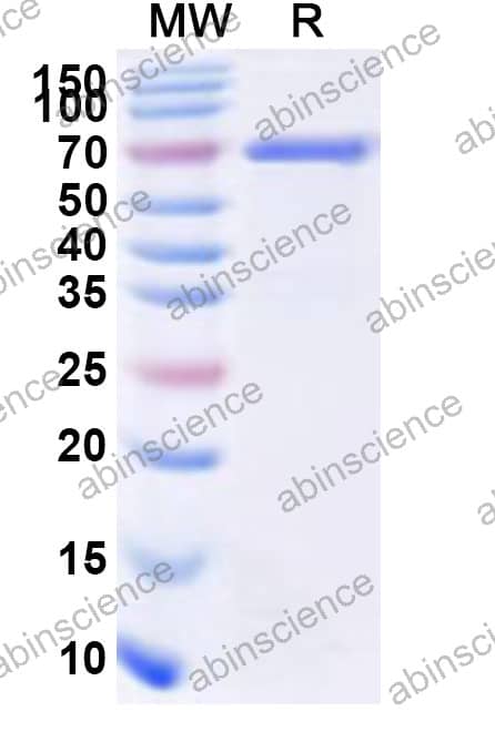 MARTX Recombinant Protein (N-His)