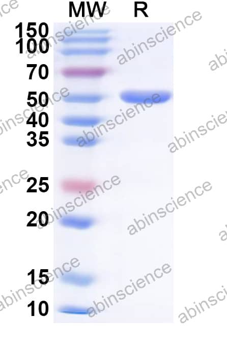 metallopeptidase Recombinant Protein (N-His)
