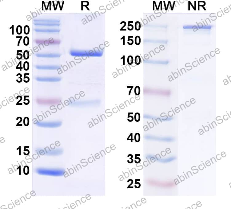 Anti-POTRA domain-containing protein/OMP Recombinant Antibody (SAA2421)