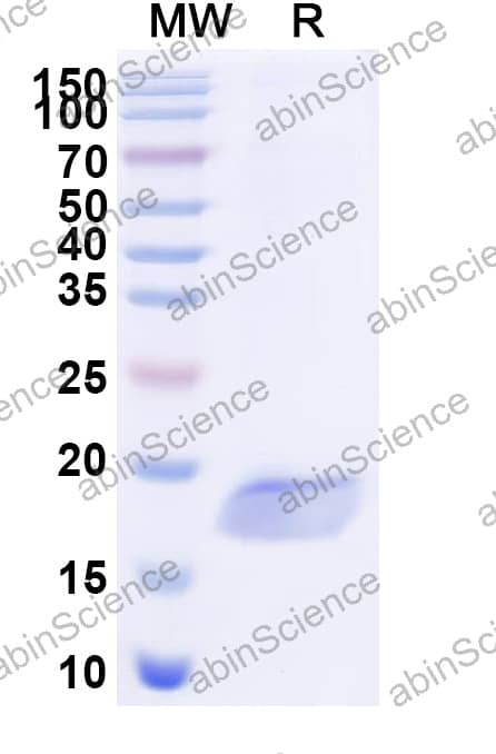 Anti-Salmonella enteritidis FliC Recombinant Nanobody (SAA2505)