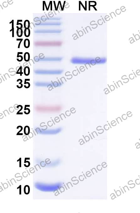 Anti-Salmonella enteritidis FliC Recombinant Antibody (SAA2505)