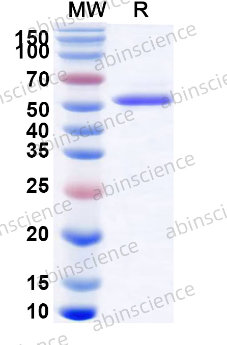 Streptococcus suis Enolase Recombinant Protein (N-His)