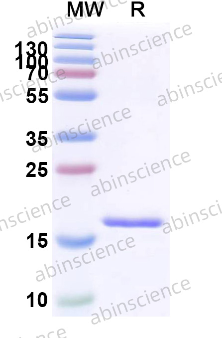 Yersinia pestis F1 capsule antigen/Caf1 Recombinant Protein (N-His)