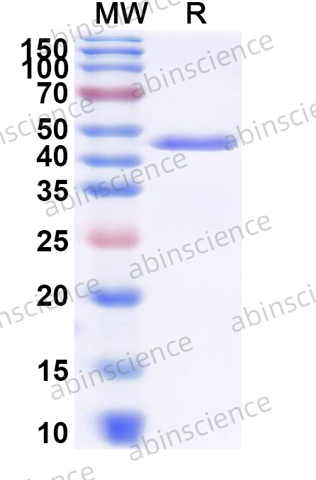 Salmonella typhimurium tolC/sinA Recombinant Protein (N-His)