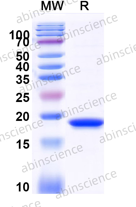 Staphylococcus aureus Thermonuclease/Tnase Recombinant Protein (N-His)