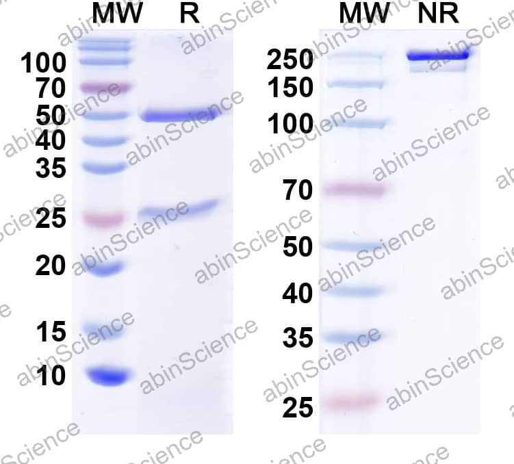 Anti-Neisseria meningitidis FHBP Recombinant Antibody (1A12)
